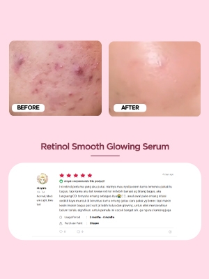 Retinol Smooth Glowing Serum 20ml